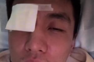 太恐怖了😱！郭艾伦：缝了四十多针 经历了人生最恐惧绝望时刻
